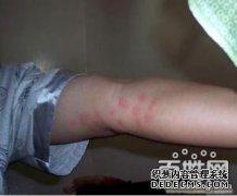 ݸɱ桪治СӣΣ